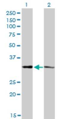 Western Blot: MED27 Antibody (8B8) [H00009442-M01]