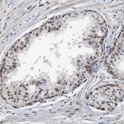 Immunohistochemistry-Paraffin: MED27 Antibody [NBP1-84377]