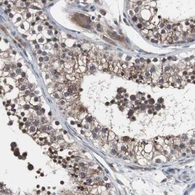 Immunohistochemistry-Paraffin: MED27 Antibody [NBP1-84377]