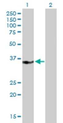 Western Blot: MED27 Antibody [H00009442-B01P]