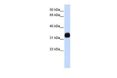 Western Blot: MED27 Antibody [NBP3-10307]