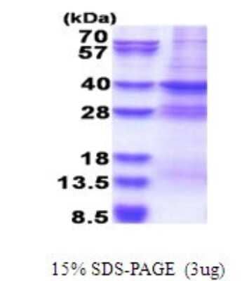 SDS-PAGE: Recombinant Human MED27 His Protein [NBP2-51663]