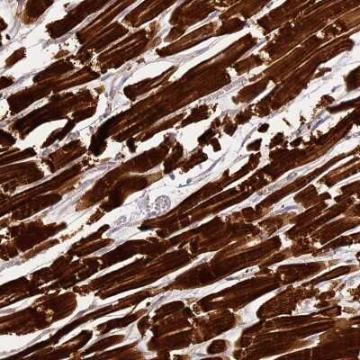 Immunohistochemistry: MED28 Antibody [NBP2-38271]