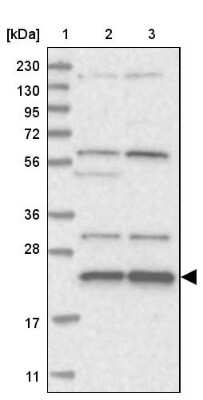 Western Blot: MED28 Antibody [NBP1-85104]