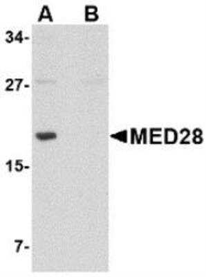 Western Blot: MED28 Antibody Blocking Peptide [NBP1-76931PEP]