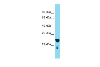 Western Blot: MED29 Antibody [NBP2-85268]