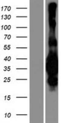 Western Blot: MED29 Overexpression Lysate [NBP2-06959]