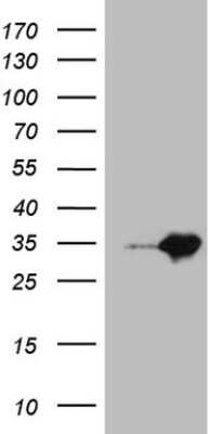 Western Blot: MED30 Antibody (OTI3B3) [NBP2-45781]