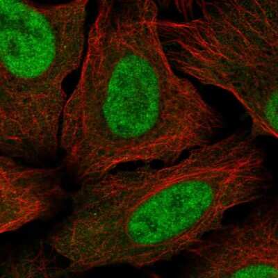 Immunocytochemistry/ Immunofluorescence: MED30 Antibody [NBP2-58363]