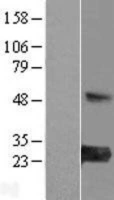 Western Blot: MED30 Overexpression Lysate [NBL1-12991]