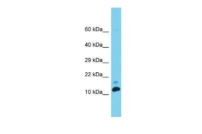 Western Blot: MED31 Antibody [NBP2-87794]