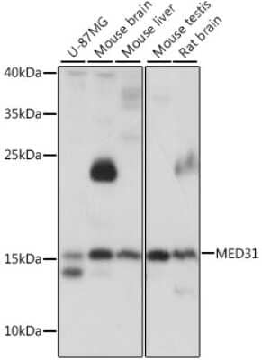 Western Blot: MED31 AntibodyBSA Free [NBP3-04436]