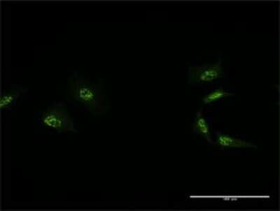 Immunocytochemistry/ Immunofluorescence: MED4 Antibody (2B10) [H00029079-M01]
