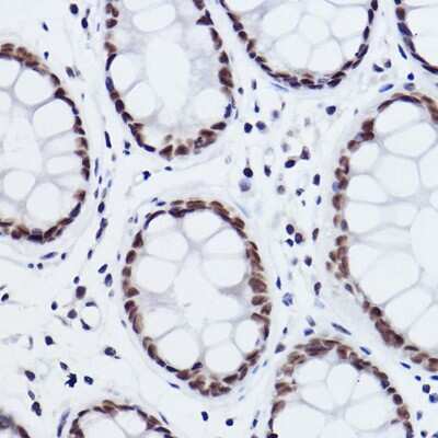 Immunohistochemistry-Paraffin: MED4 Antibody (8T5C9) [NBP3-15287]