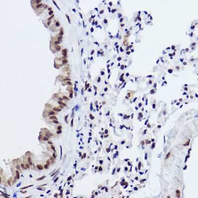 Immunohistochemistry-Paraffin: MED4 Antibody (8T5C9) [NBP3-15287]