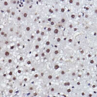 Immunohistochemistry-Paraffin: MED4 Antibody (8T5C9) [NBP3-15287]