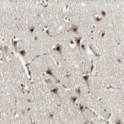 Immunohistochemistry-Paraffin: MED4 Antibody [NBP1-84977]
