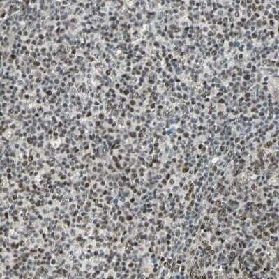 Immunohistochemistry-Paraffin: MED4 Antibody [NBP1-84977]