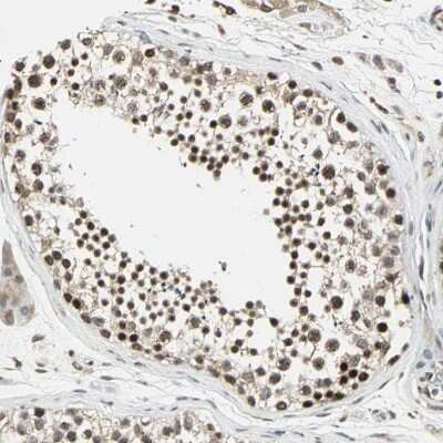 Immunohistochemistry-Paraffin: MED4 Antibody [NBP1-84977]