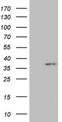 Western Blot: MED6 Antibody (OTI3C9) [NBP2-45811]