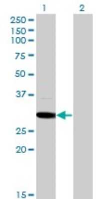 Western Blot: MED6 Antibody (4C2) [H00010001-M07]