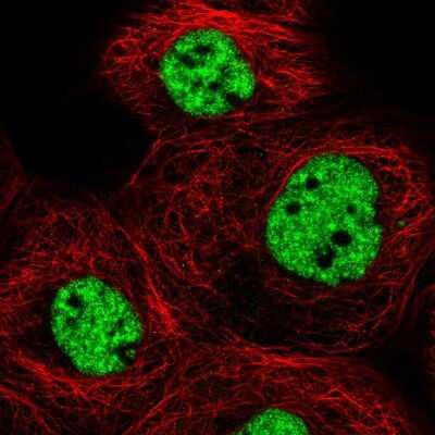 Immunocytochemistry/ Immunofluorescence: MED6 Antibody [NBP2-38118]