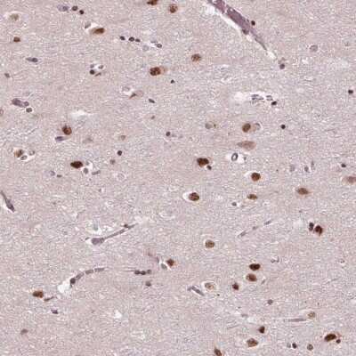 Immunohistochemistry-Paraffin: MED6 Antibody [NBP2-38118]