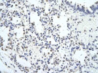 Immunohistochemistry: MED6 Antibody [NBP3-10484]