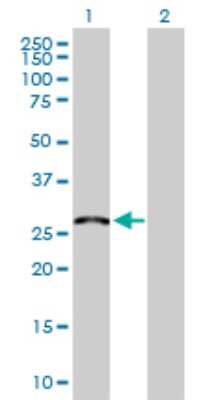 Western Blot: MED6 Antibody [H00010001-D01P]