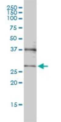 Western Blot: MED7 Antibody (3E7) [H00009443-M01]