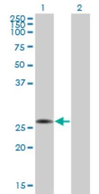 Western Blot: MED7 Antibody (3E7) [H00009443-M01]