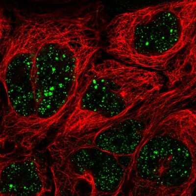 Immunocytochemistry/ Immunofluorescence: MED7 Antibody [NBP2-57915]