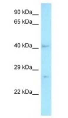 Western Blot: MED7 Antibody [NBP1-98339]