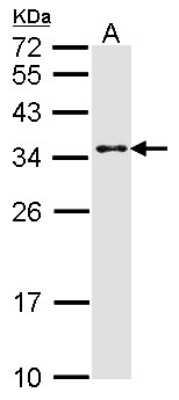 Western Blot: MED7 Antibody [NBP2-17258]