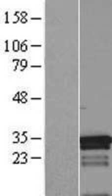 Western Blot: MED7 Overexpression Lysate [NBL1-12994]