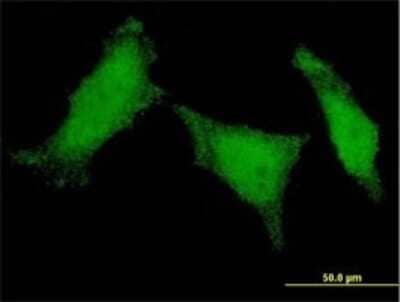 Immunocytochemistry/ Immunofluorescence: MED8 Antibody (1D3) [H00112950-M01]