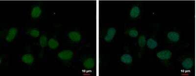 Immunocytochemistry/ Immunofluorescence: MED8 Antibody [NBP2-17259]