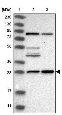 Western Blot: MED8 Antibody [NBP1-89014]