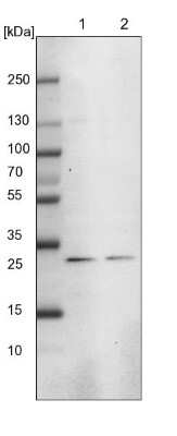 Western Blot: MED8 Antibody [NBP1-89015]