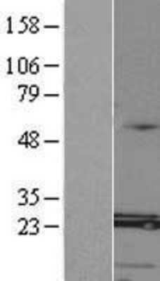 Western Blot: MED8 Overexpression Lysate [NBL1-12995]