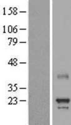 Western Blot: MED8 Overexpression Lysate [NBP2-05847]