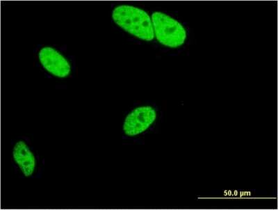 Immunocytochemistry/ Immunofluorescence: MED9 Antibody (7F1) [H00055090-M03]