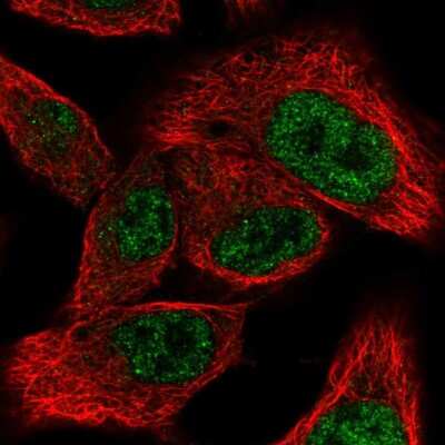 Immunocytochemistry/ Immunofluorescence: MED9 Antibody [NBP2-31639]