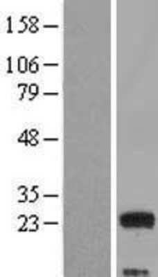 Western Blot: MED9 Overexpression Lysate [NBL1-12997]