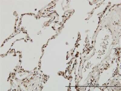 Immunohistochemistry-Paraffin: MEF2A Antibody (1A10) [H00004205-M02]