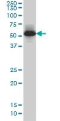 Western Blot: MEF2A Antibody (1A10) [H00004205-M02]