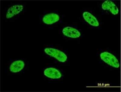 Immunocytochemistry/ Immunofluorescence: MEF2A Antibody (1A7) [H00004205-M06]