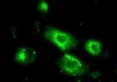 Immunocytochemistry/ Immunofluorescence: MEF2A Antibody (1C8) [H00004205-M15]