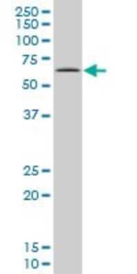 Western Blot: MEF2A Antibody (1C8) [H00004205-M15]