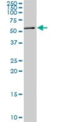 Western Blot: MEF2A Antibody (1F8) [H00004205-M08]
